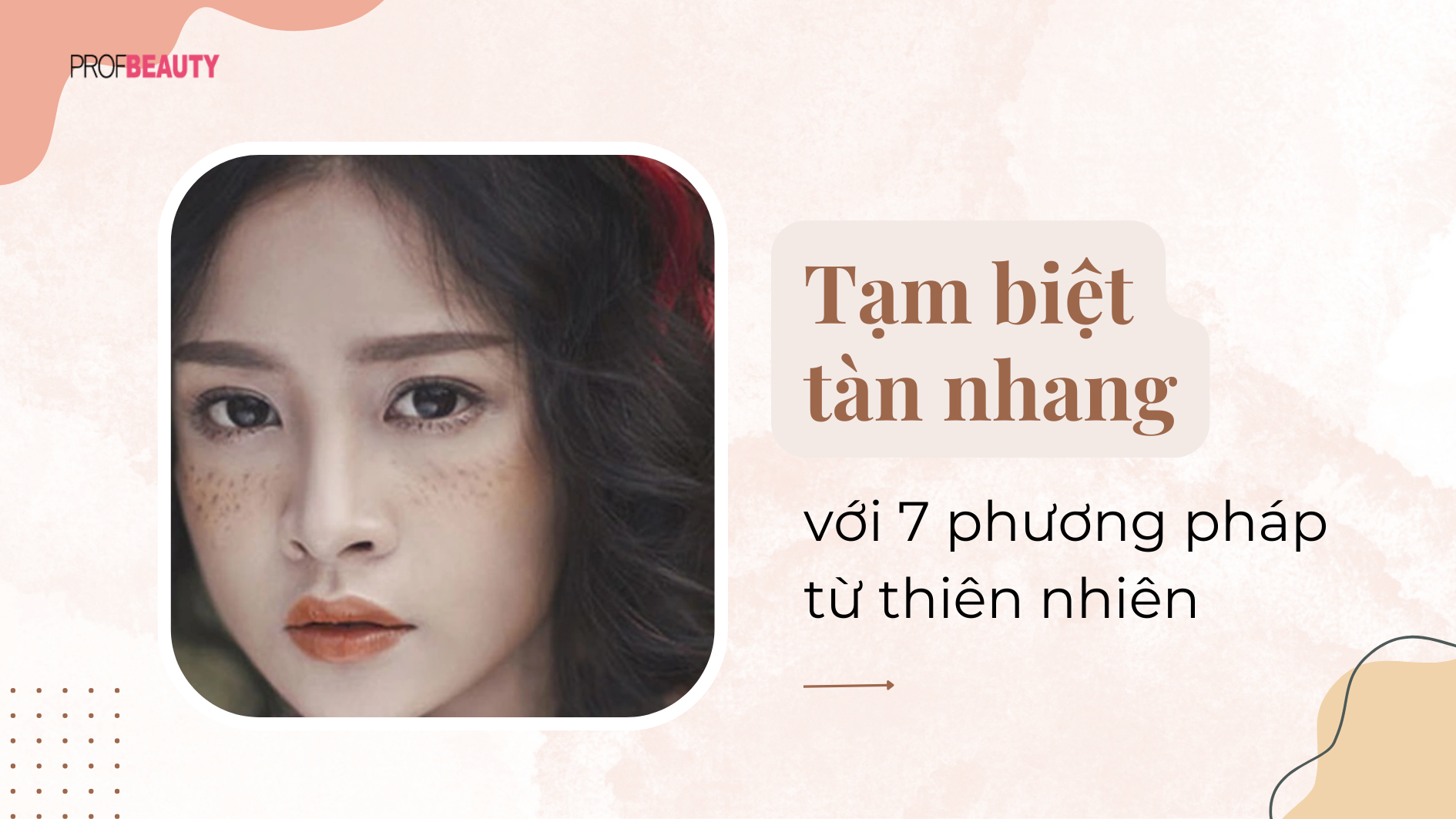 Tạm biệt tàn nhang với 7 phương pháp từ thiên nhiên